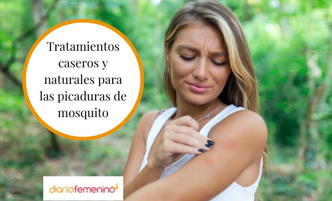 Remedios Caseros Para Las Picaduras De Mosquito