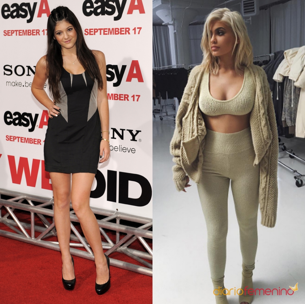 El antes y el después de Kylie Jenner