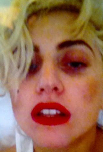 Lady Gaga. Los accidentes más absurdos sobre el escenario