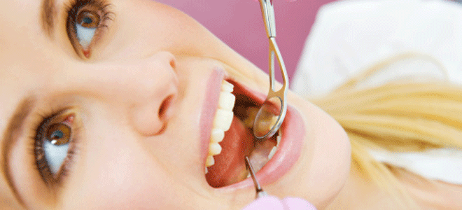 Resultado de imagen para ENDODONCIA