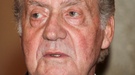 La misteriosa evolución del ojo morado del Rey Juan Carlos