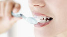 Blanqueadores dentales: riesgos y alternativas