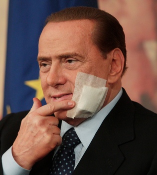 Reaparece Silvio Berlusconi tras su operación de mandíbula