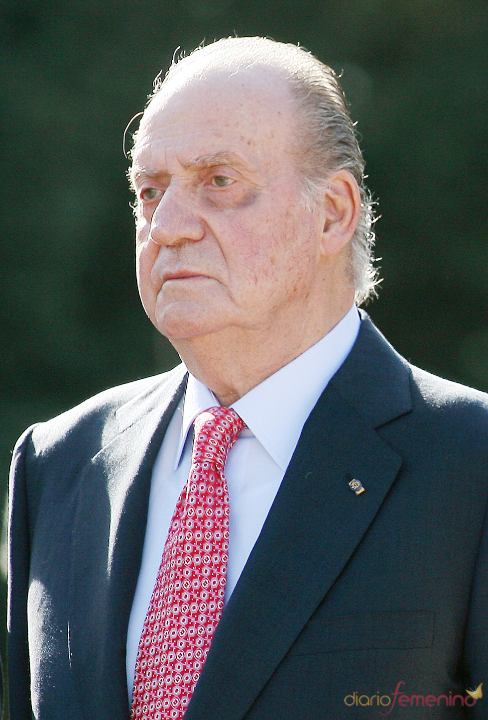 El Rey con el ojo morado
