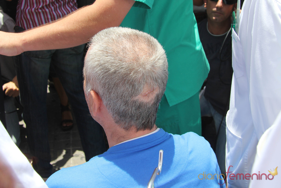 Brecha en la cabeza de José Ortega Cano como consecuencia de su accidente