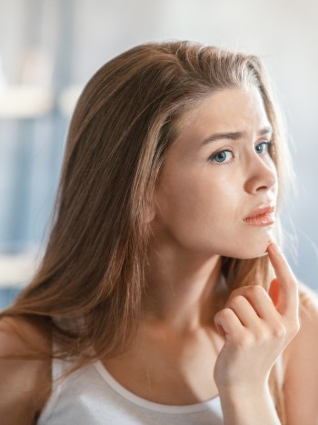 Dermatitis y acné al mismo tiempo: ¿cuál es el tratamiento más indicado?