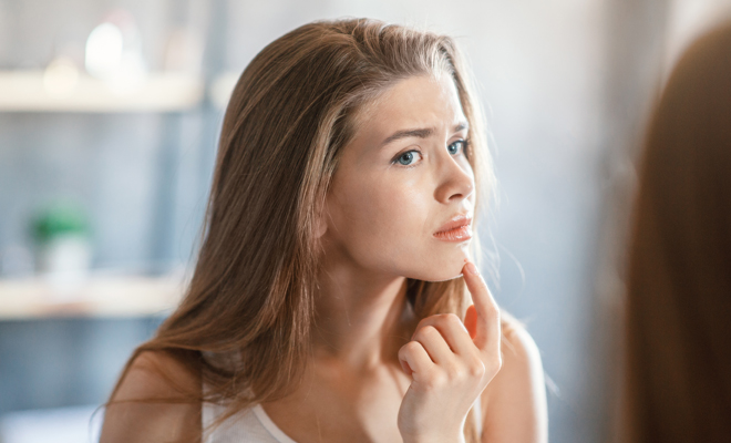 Dermatitis y acné al mismo tiempo: ¿es posible?