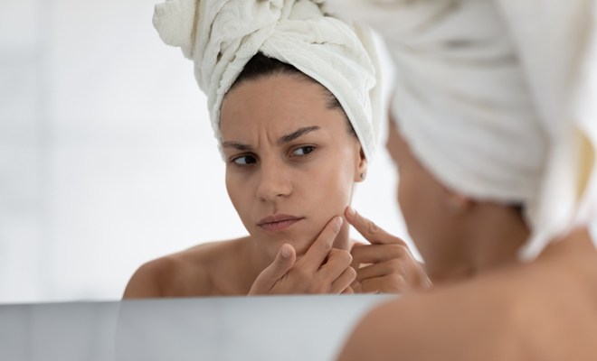 ¿La contaminación o el sol producen acné?