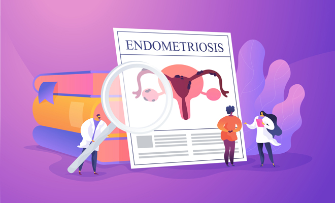 Consejos para cuidarte si padeces endomertriosis