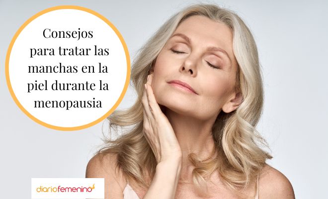 Causas y remedios de las manchas en la piel durante la menopausia