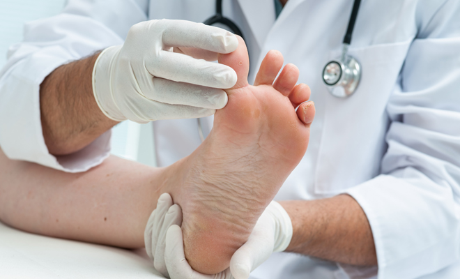 ¿Cuáles son las causas de los hongos en las uñas?