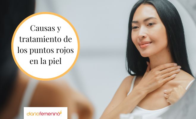 ¿Qué son esos puntos rojos en la piel?