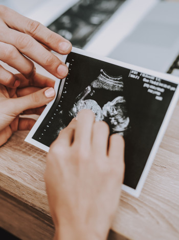 Soñar que dejas a alguien embarazada: ¿irresponsabilidad o alegría?