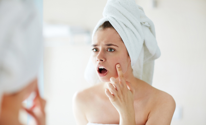 Tips para eliminar el acné a los 30