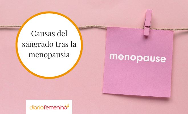 Sangrado después de la menopausia: conoce las causas Sangrado después de la menopausia: ¿por qué se produce?