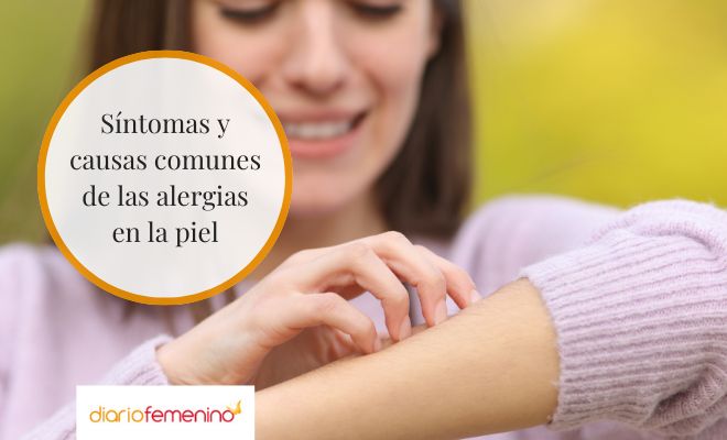 Diferentes síntomas y causas de las alergias en la piel
