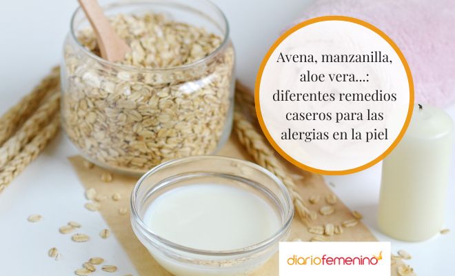 Remedios caseros que pueden ayudarte para aliviar los síntomas de las alergias en la piel