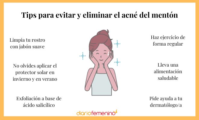 Remedios para eliminar el acné de la barbilla