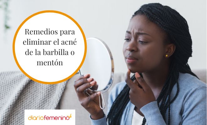 Remedios caseros y naturales para el acné del mentón