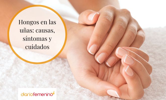 Cuáles son las causas de los hongos en las uñas y cómo cuidarlas