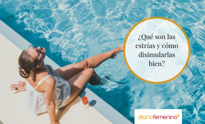 Qué son las estrías y cómo disimularlas