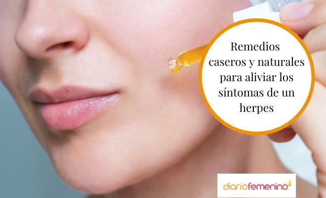 Cómo aliviar los síntomas de un herpes con remedios caseros