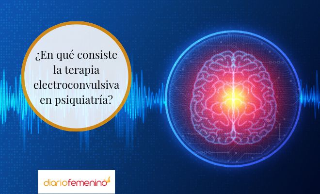 La terapia de choque en psiquiatría