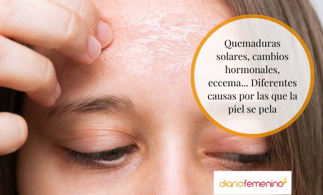 Causas por las que la piel se puede pelar