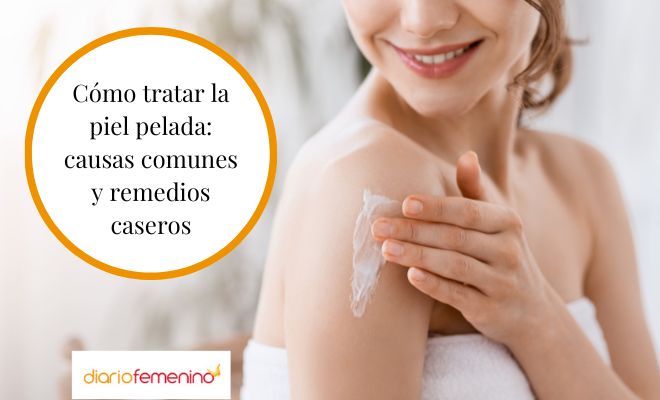 Causas por las que se pela la piel y algunos remedios naturales