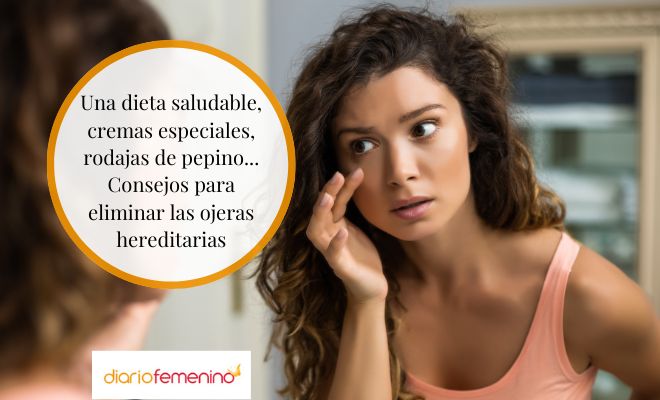 ¿Cómo eliminar las ojeras si son genéticas?