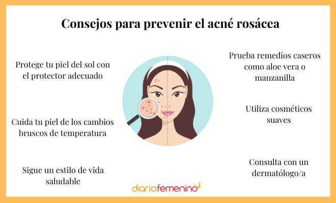¿Cómo prevenir el acné rosácea en tu piel?