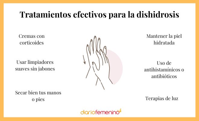 Tratamientos para la dishidrosis