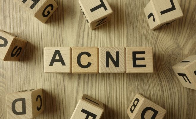 Causas del acné en adultos