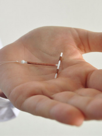 Consejos de especialista sobre el uso del DIU (mirena o de cobre)