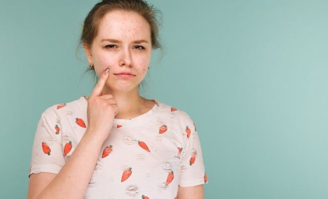 Las causas más frecuentes del acné