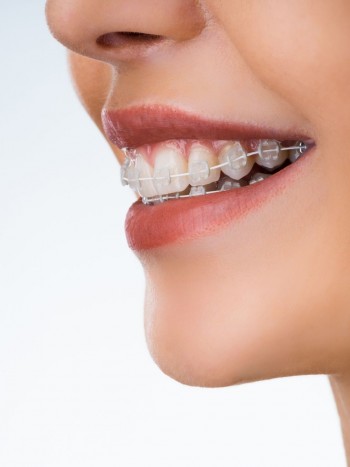 Soñar que se te caen los brackets: un aviso de tu inseguridad