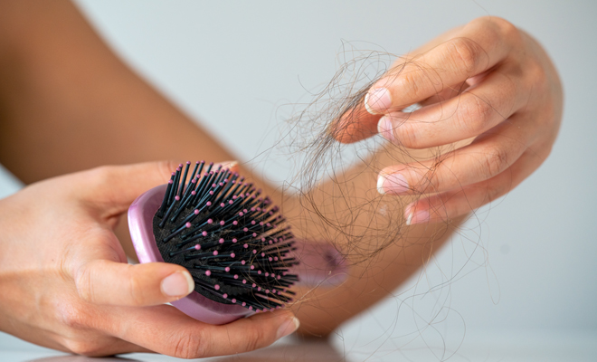 Tipos y características de la alopecia femenina