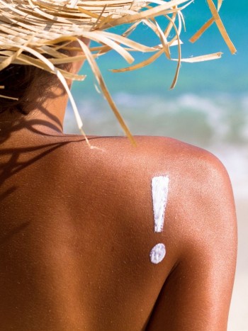 Peligros de exponerse al sol: ¿qué protector usar para cuidar la piel?