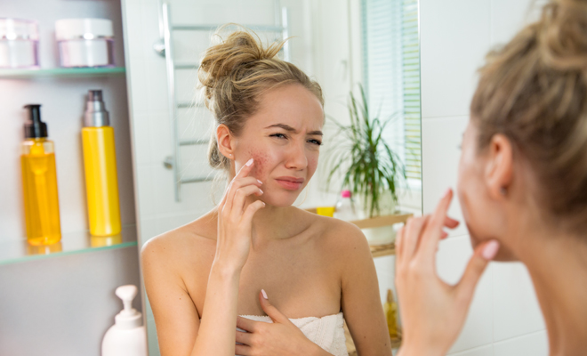 Formas de prevenir las marcas de los granos