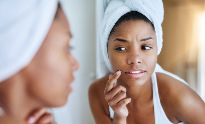 Cuando una espinilla se convierte en herida, ¿qué debo hacer?