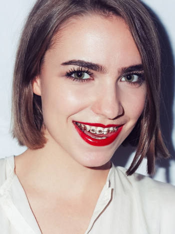 Soñar que te ponen brackets: una inversión de futuro