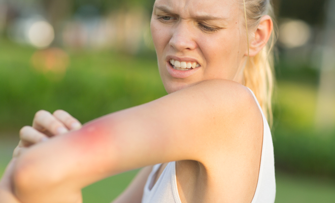 Significado de soñar que eres alérgica a la picadura de una abeja