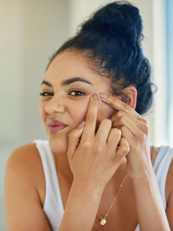 Medicamentos para el acné: qué medicinas tomar para quitar los granos