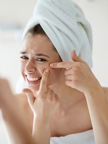 ¿Los lácteos provocan acné? La relación entre la leche y los granos