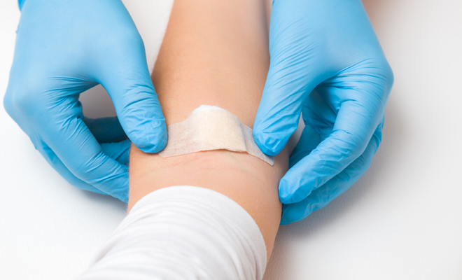 Todo lo que debes saber antes de acudir a donar sangre