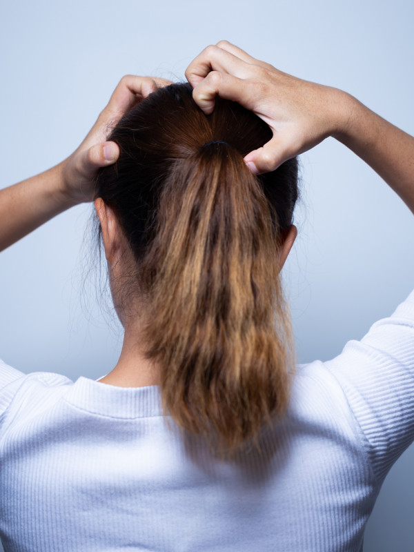 Soñar con piojos: liendres que te avisan de traición
