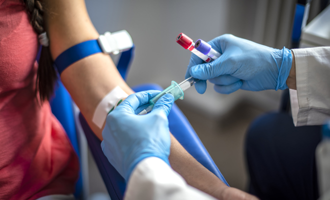 Donar sangre con colesterol alto: ¿Sí o no?