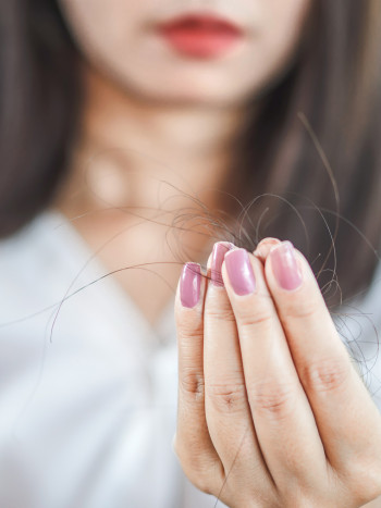 Pérdida de cabello o alopecia: ¿a qué médico o especialista debo acudir?