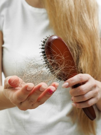 Alopecia frontal fibrosante en mujeres: lo que sabemos hasta ahora