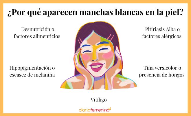 Conoce los motivos más comunes por los que aparecen manchas en la piel